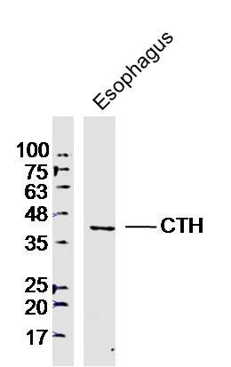 Anti-CTH Polyclonal Antibody