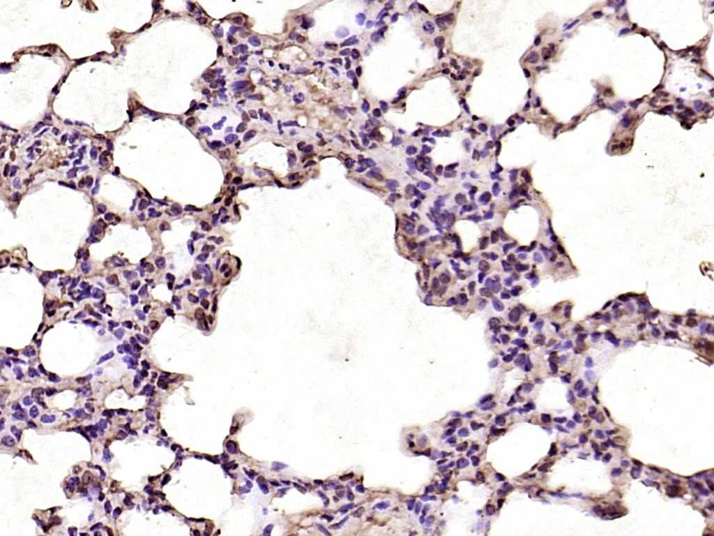 Anti-CDK6 Polyclonal Antibody