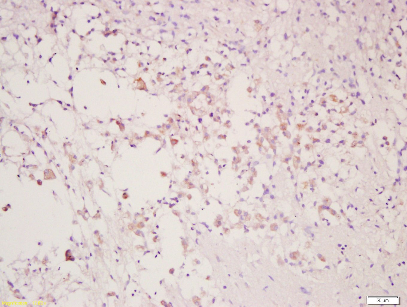 Anti-CLEC9A Polyclonal Antibody