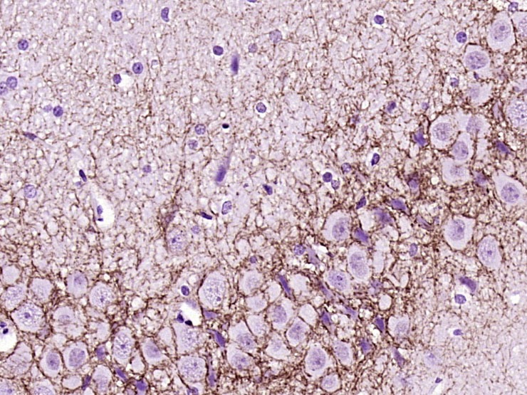 Anti-CNR1 Polyclonal Antibody