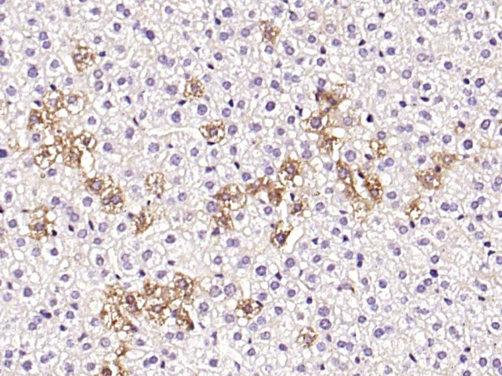 Anti-Coagulation Factor VIII/FVIII/F8 Polyclonal Antibody 2