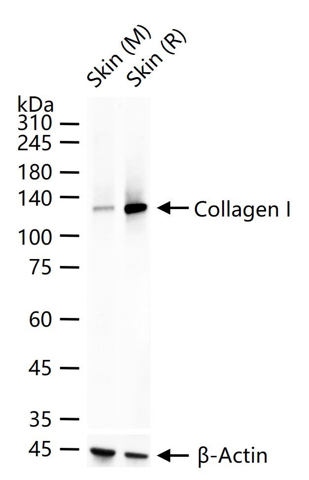 Anti-Collagen I/COL1A1 Polyclonal Antibody 2