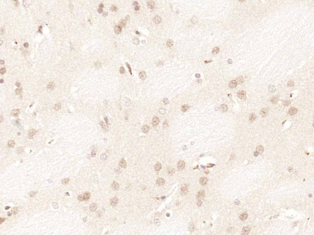 Anti-CDKN2A Polyclonal Antibody 2