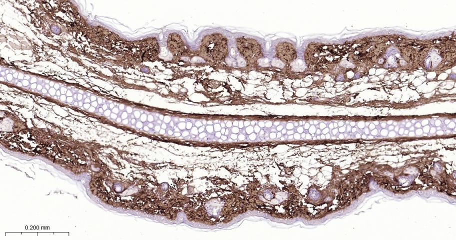 Anti-Collagen I/COL1A1 Polyclonal Antibody 2