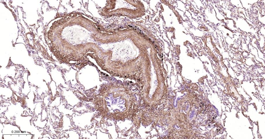 Anti-Collagen I/COL1A1 Polyclonal Antibody 2