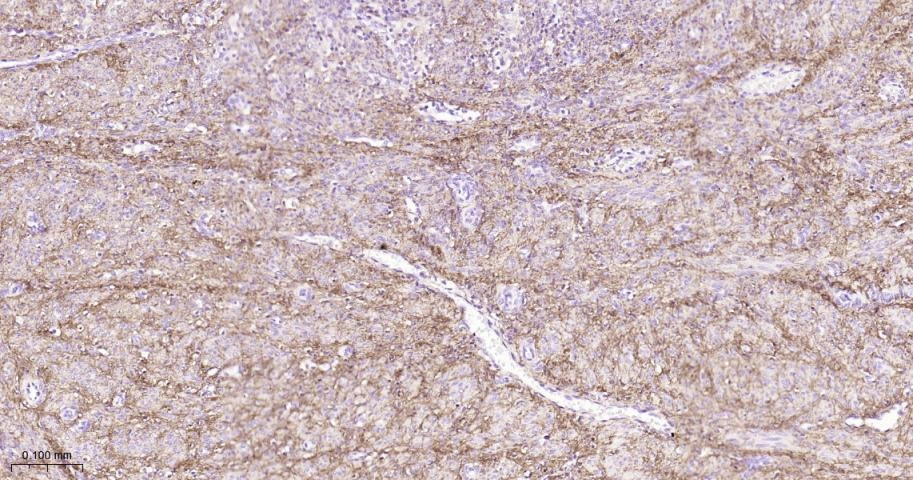 Anti-Collagen I/COL1A1 Polyclonal Antibody 2