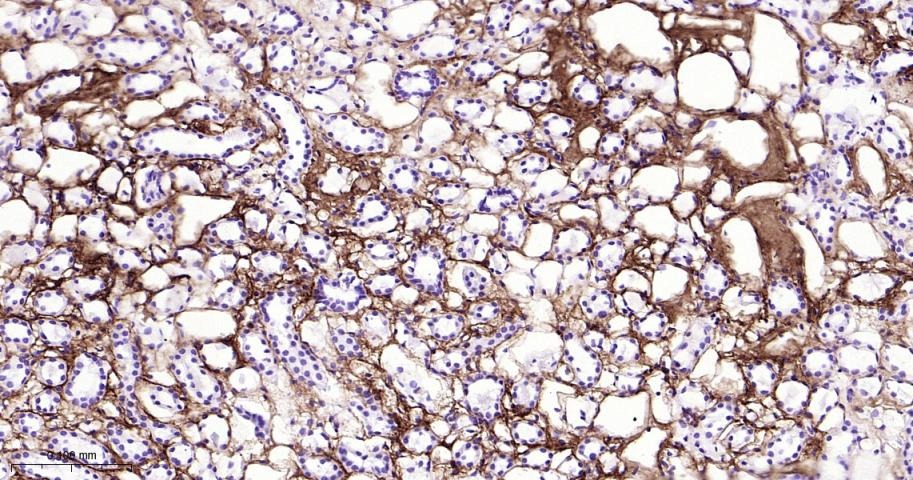 Anti-Collagen I/COL1A1 Polyclonal Antibody 2