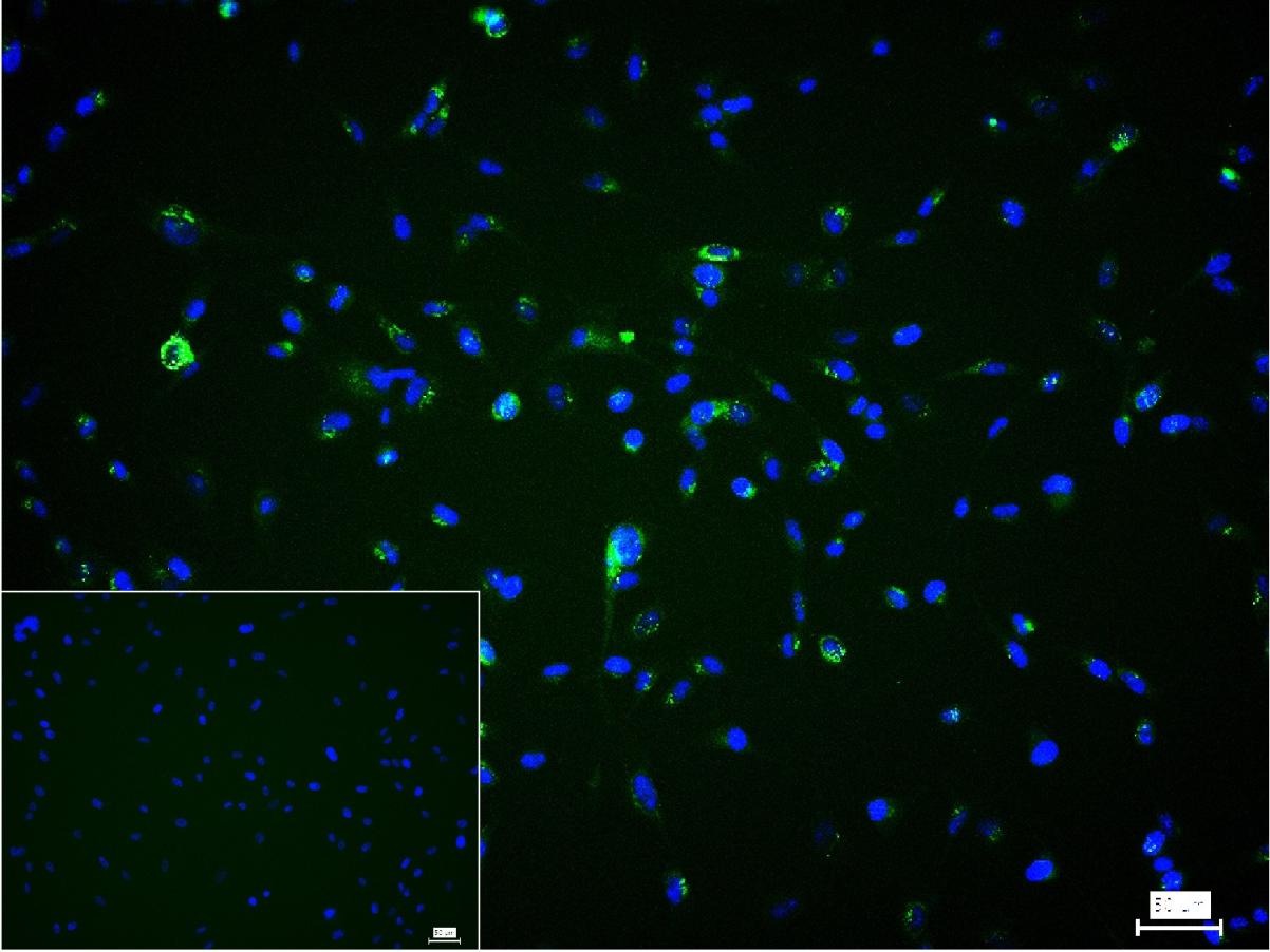 Anti-Collagen I/COL1A1 Polyclonal Antibody 2