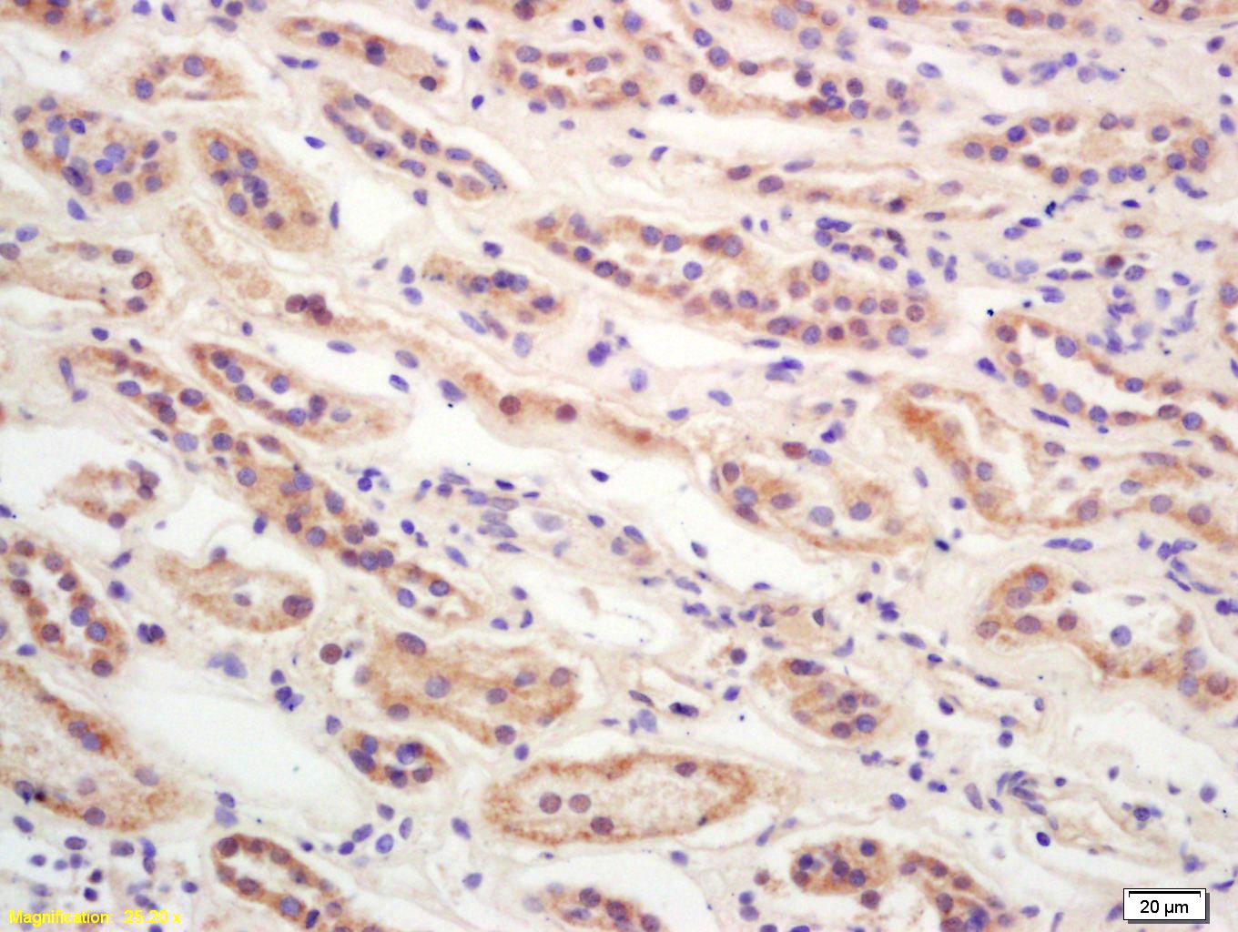 Anti-CDKN2A Polyclonal Antibody