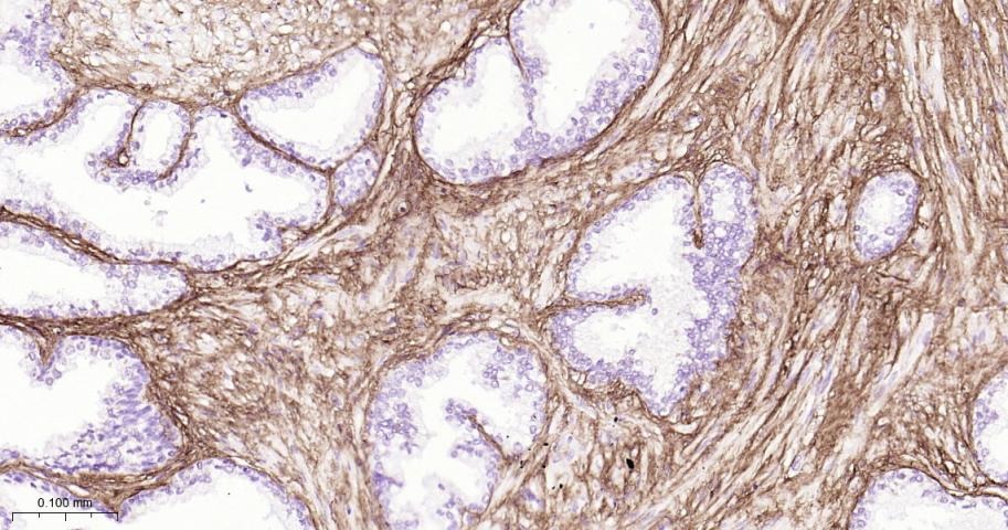 Anti-Collagen I/COL1A1 Polyclonal Antibody 2