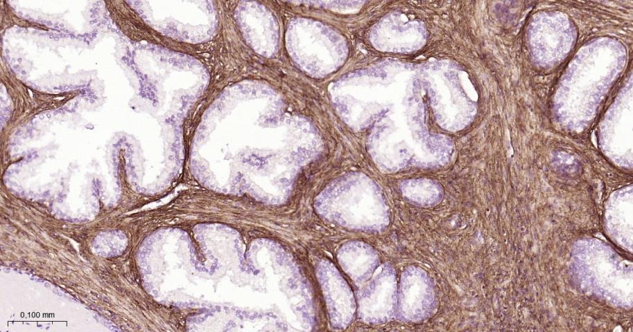Anti-Collagen I/COL1A1 Polyclonal Antibody 2