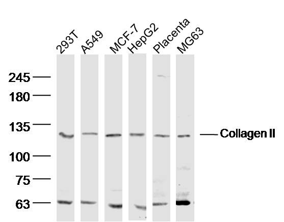 Anti-Collagen II/COL2A1 Polyclonal Antibody
