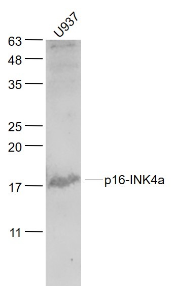 Anti-CDKN2A Polyclonal Antibody 2