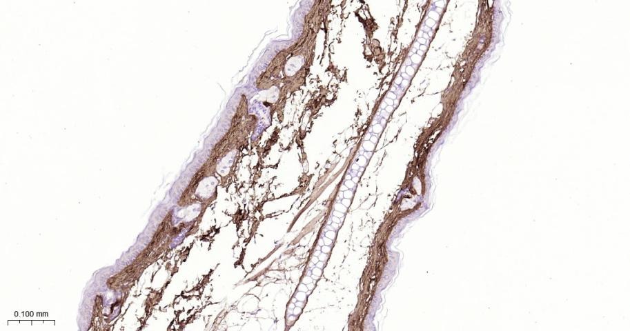 Anti-Collagen I/COL1A1 Polyclonal Antibody 2