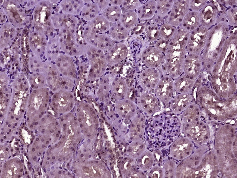 Anti-HIF-3 alpha Polyclonal Antibody