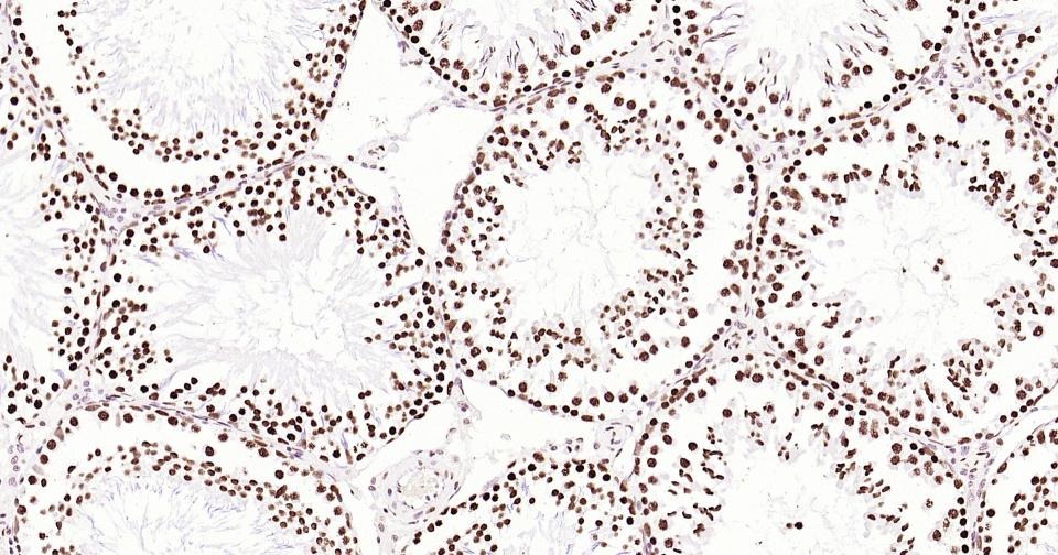 Histone H3 Nuclear Loading Control Antibody (6Z247)