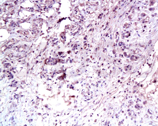 Anti-HGFR/c-Met Polyclonal Antibody