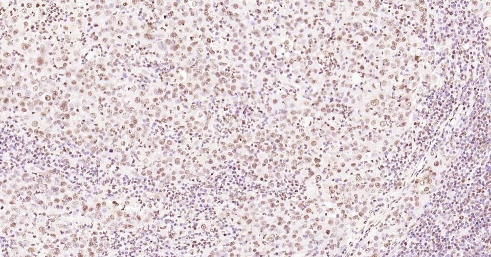Histone H3 Nuclear Loading Control Antibody (6Z247)