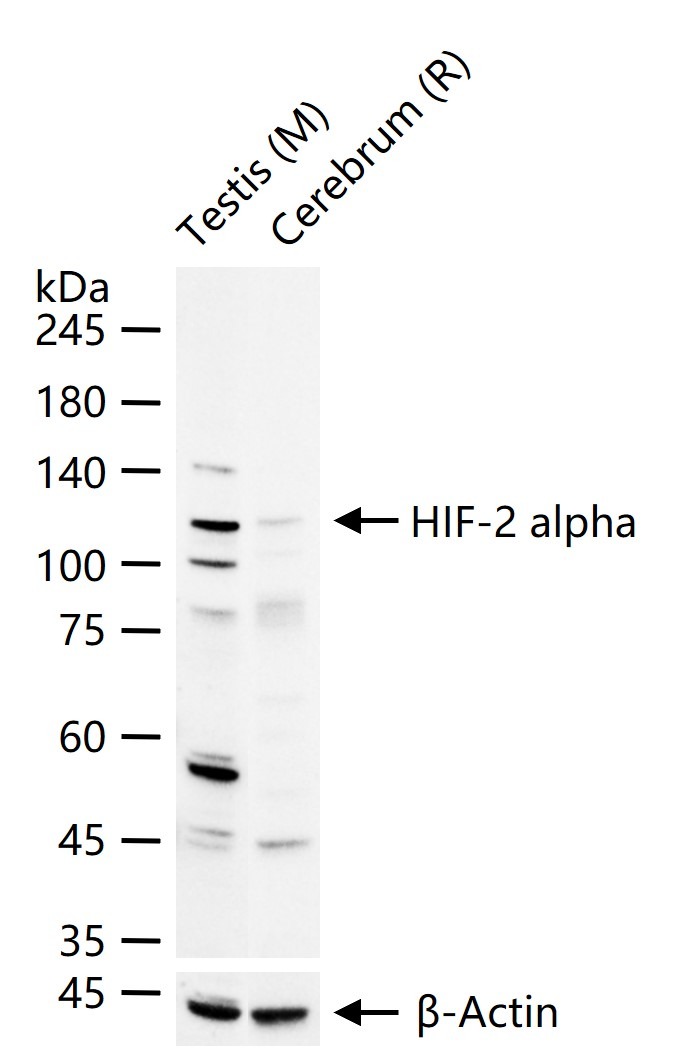 Anti-HIF-2 alpha Polyclonal Antibody