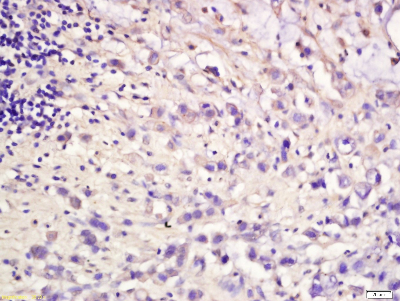 Anti-HGFR/c-Met Polyclonal Antibody