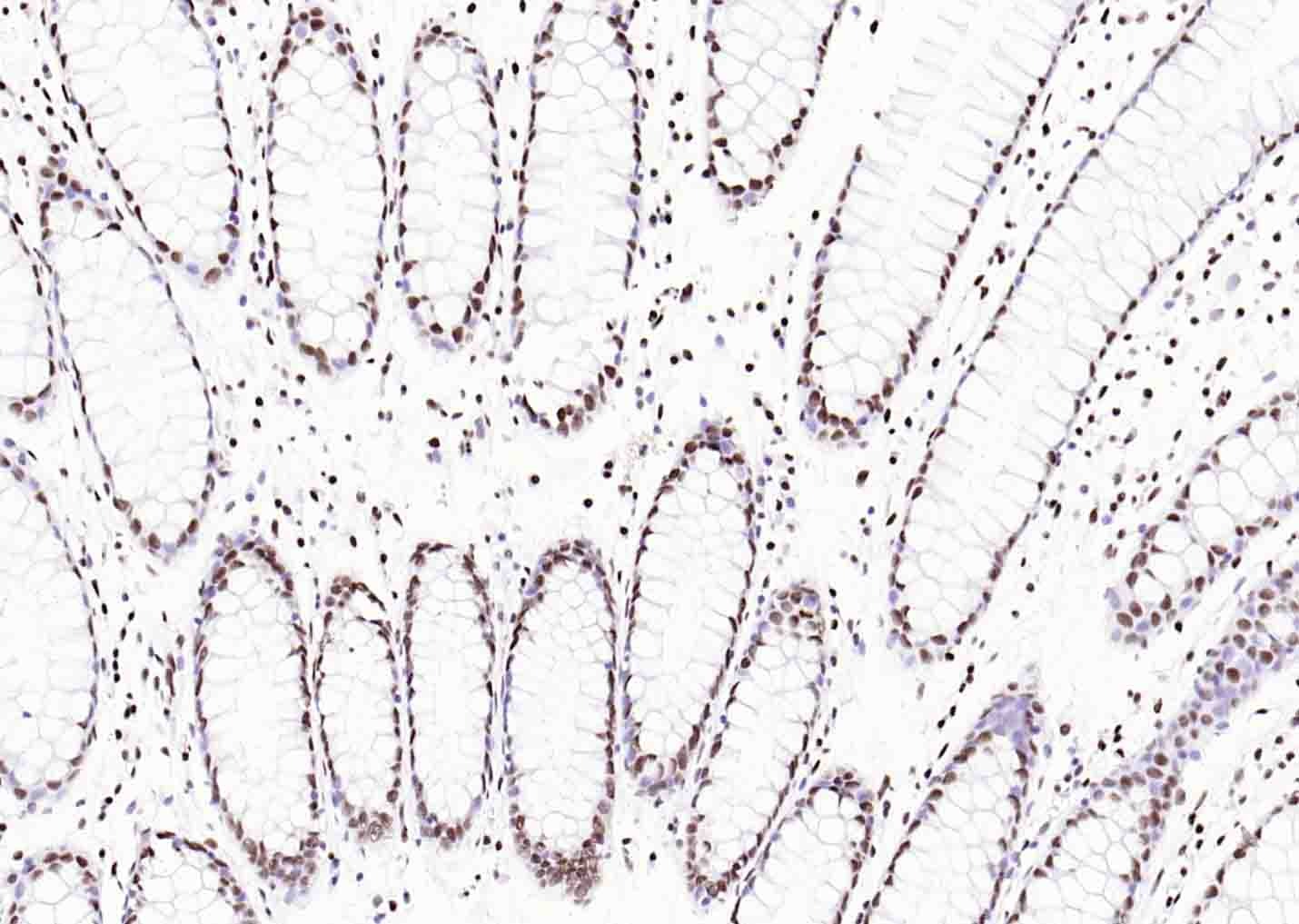 Histone H3 Nuclear Loading Control Antibody (6Z247)