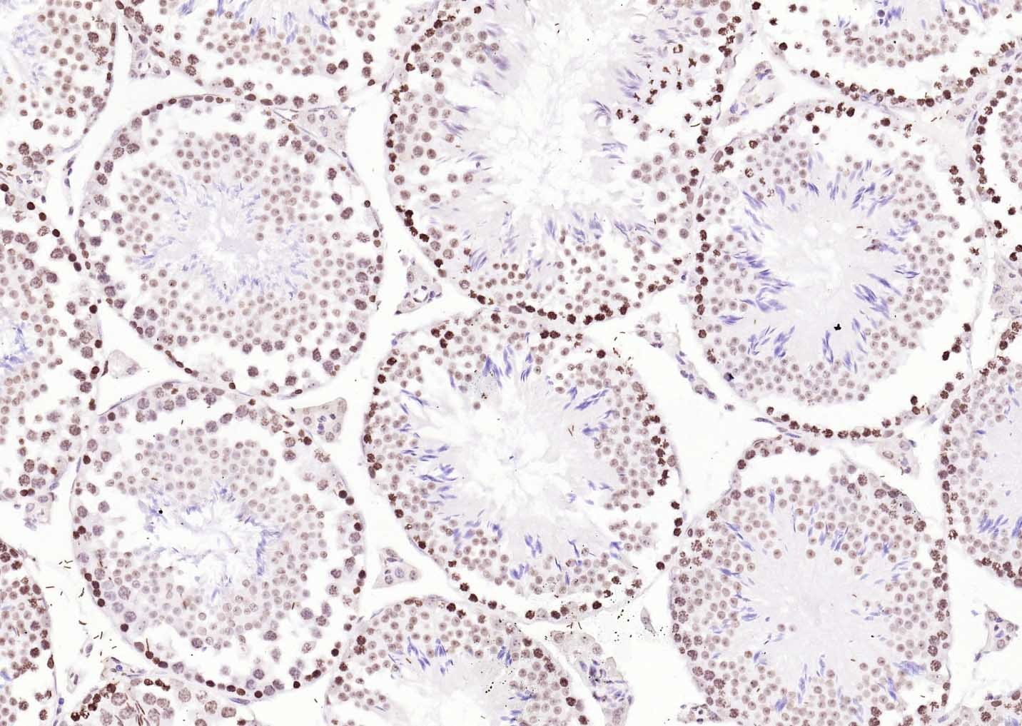 Histone H3 Nuclear Loading Control Polyclonal Antibody