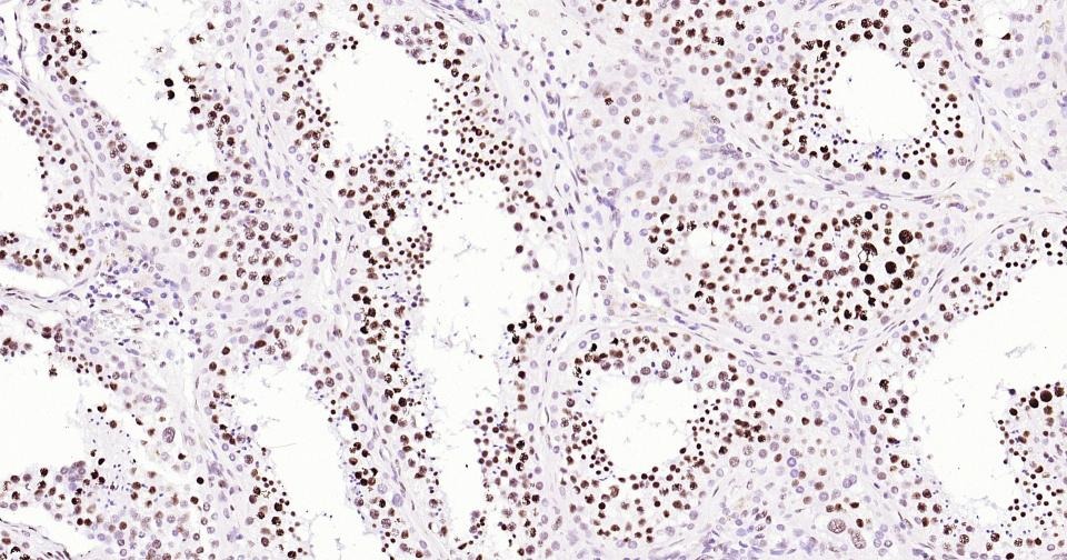Histone H3 Nuclear Loading Control Antibody (6Z247)