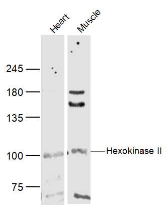 Anti-HK2 Polyclonal Antibody