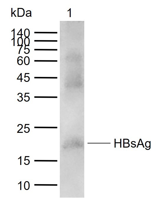 Anti-HBsAg Polyclonal Antibody
