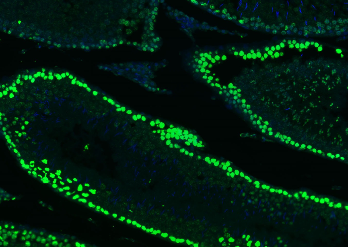 Histone H3 Nuclear Loading Control Polyclonal Antibody
