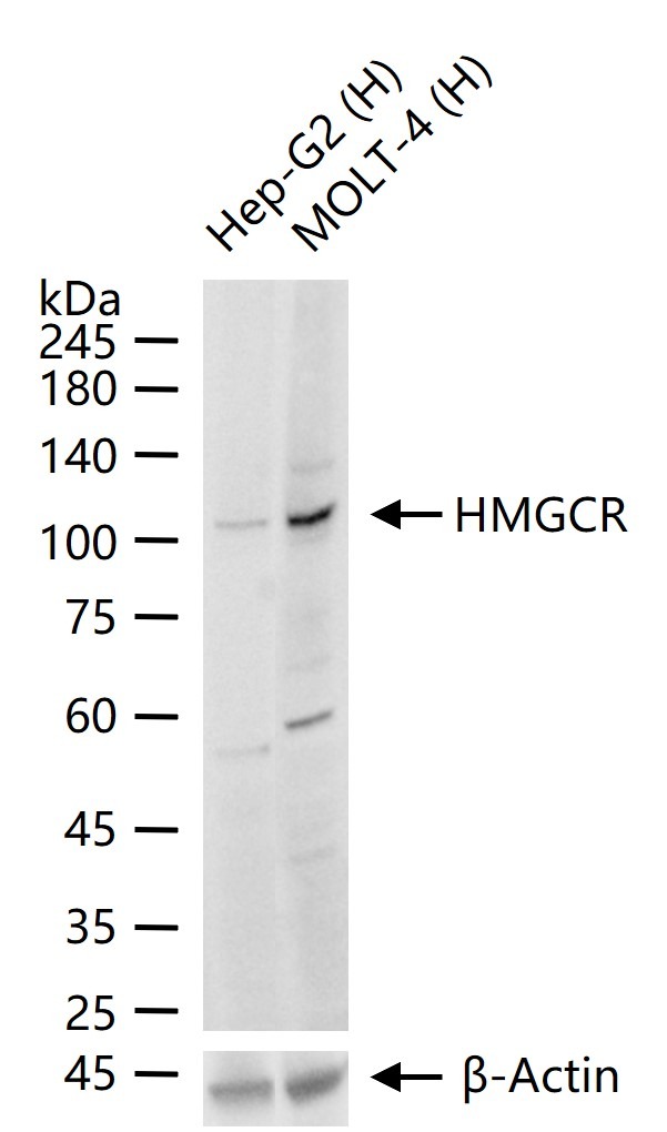 Anti-HMGCR Polyclonal Antibody