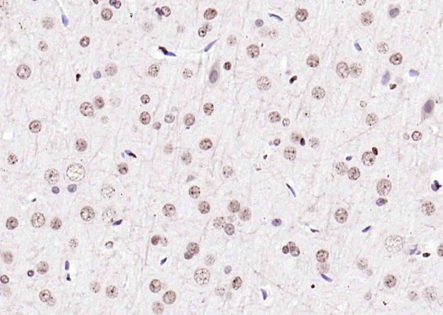 Anti-Histone H3.1 Polyclonal Antibody