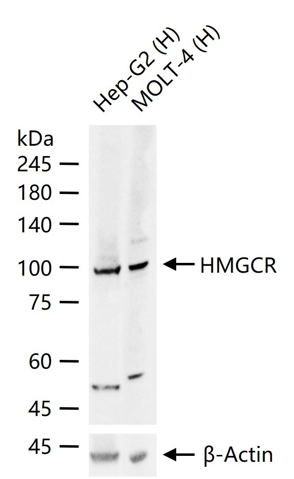 Anti-HMGCR Antibody (7G912)