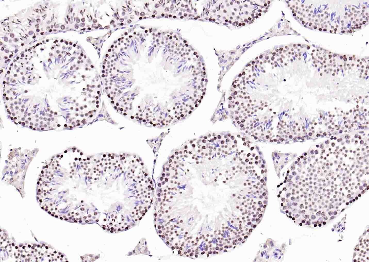 Anti-Histone H3.1 Polyclonal Antibody