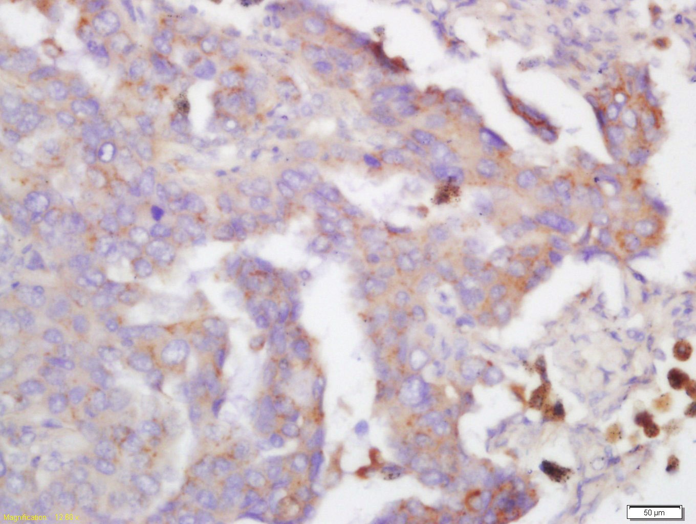 Anti-hydroxyproline Polyclonal Antibody