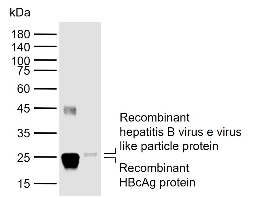 Anti-HBeAg Antibody (5E79)