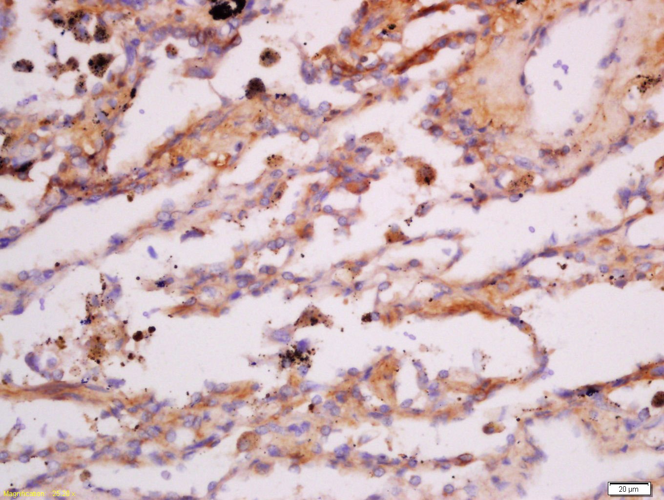 Anti-KRT7 Polyclonal Antibody