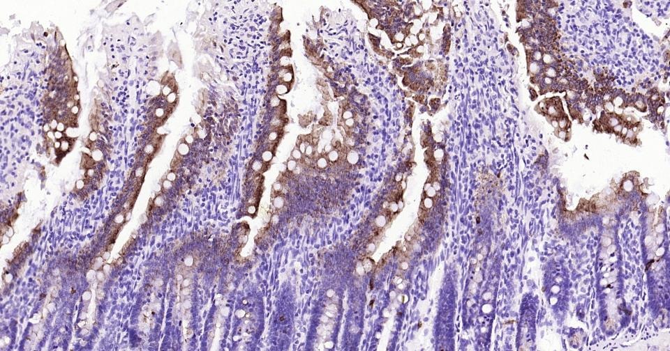 Anti-KRT20 Antibody (9H184)