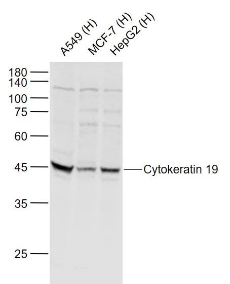 Anti-KRT19 Polyclonal Antibody