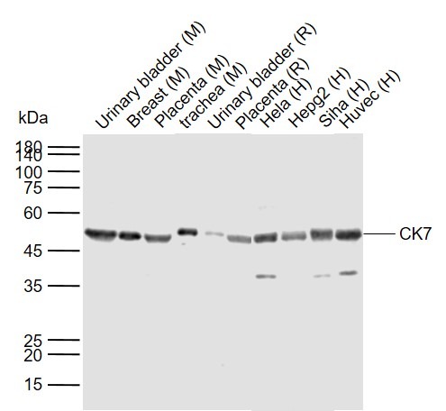 Anti-KRT7 Polyclonal Antibody