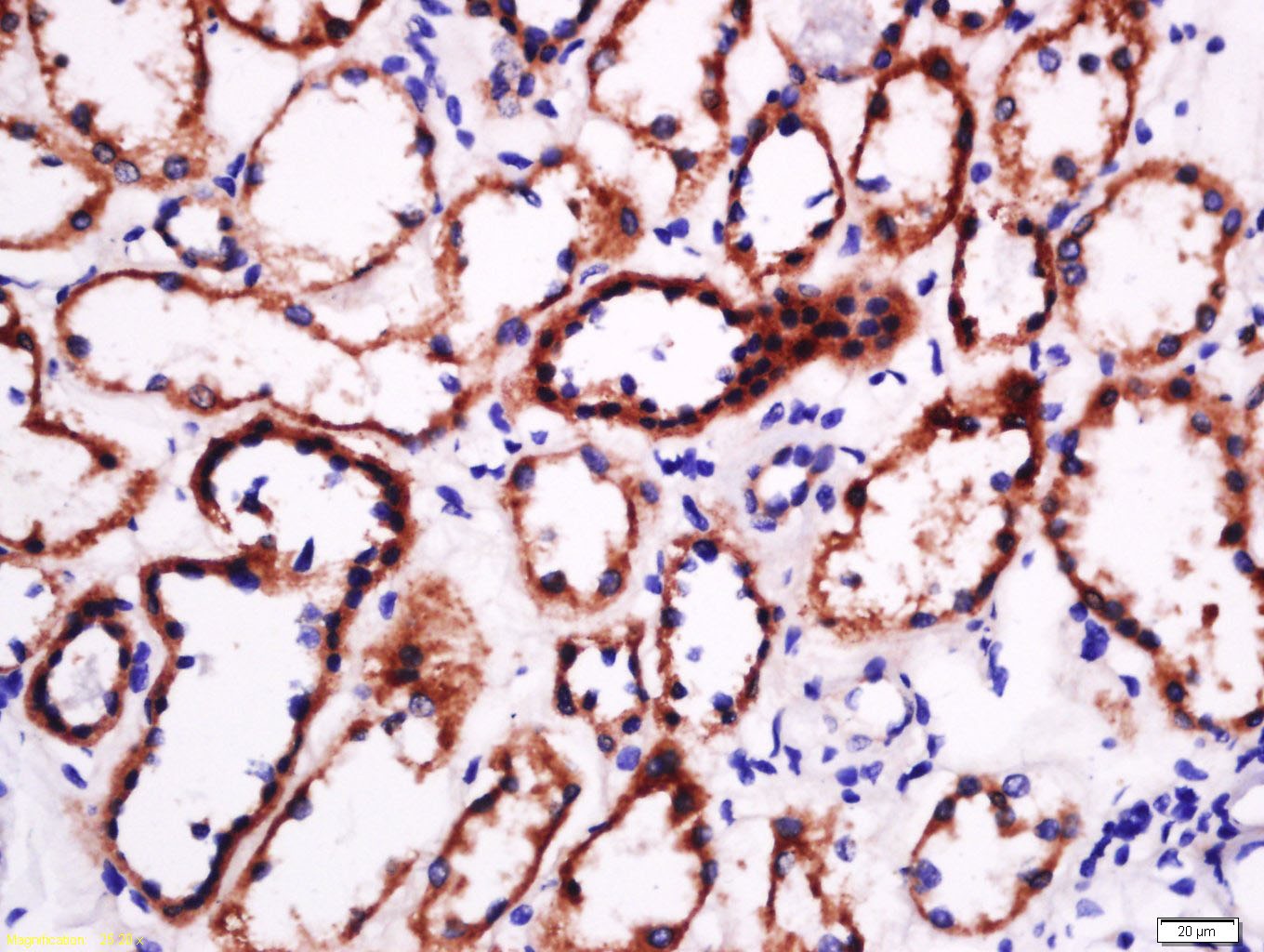 Anti-Laminin subunit beta-1 Polyclonal Antibody