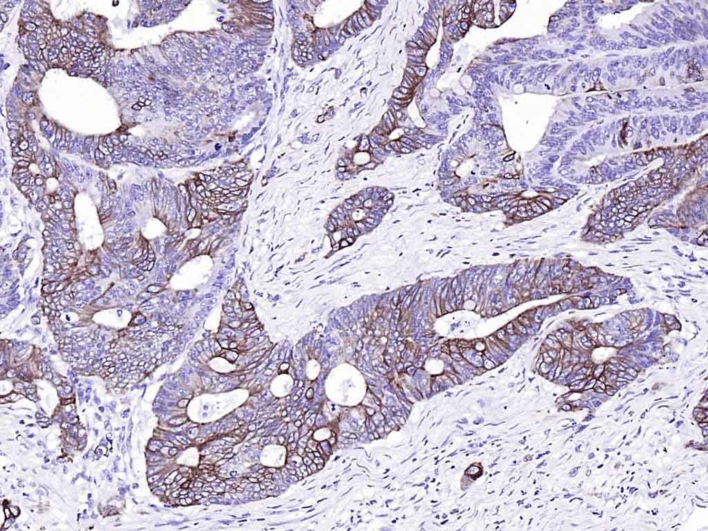 Anti-KRT20 Antibody (9H184)