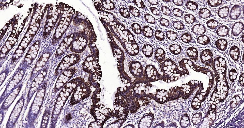 Anti-KRT20 Antibody (9H184)