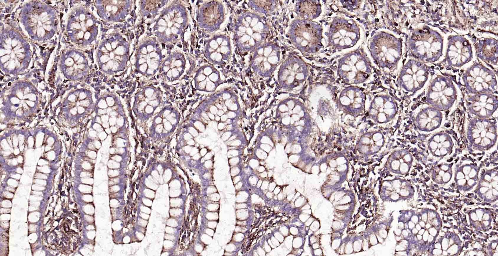 Anti-LAMP1 Polyclonal Antibody