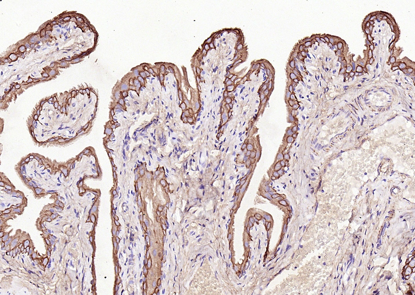 Anti-KRT7 Polyclonal Antibody