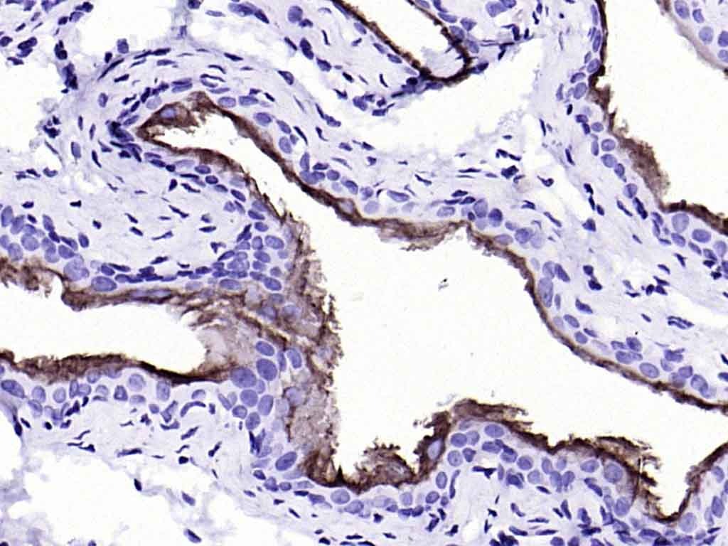 Anti-KRT20 Antibody (9H184)
