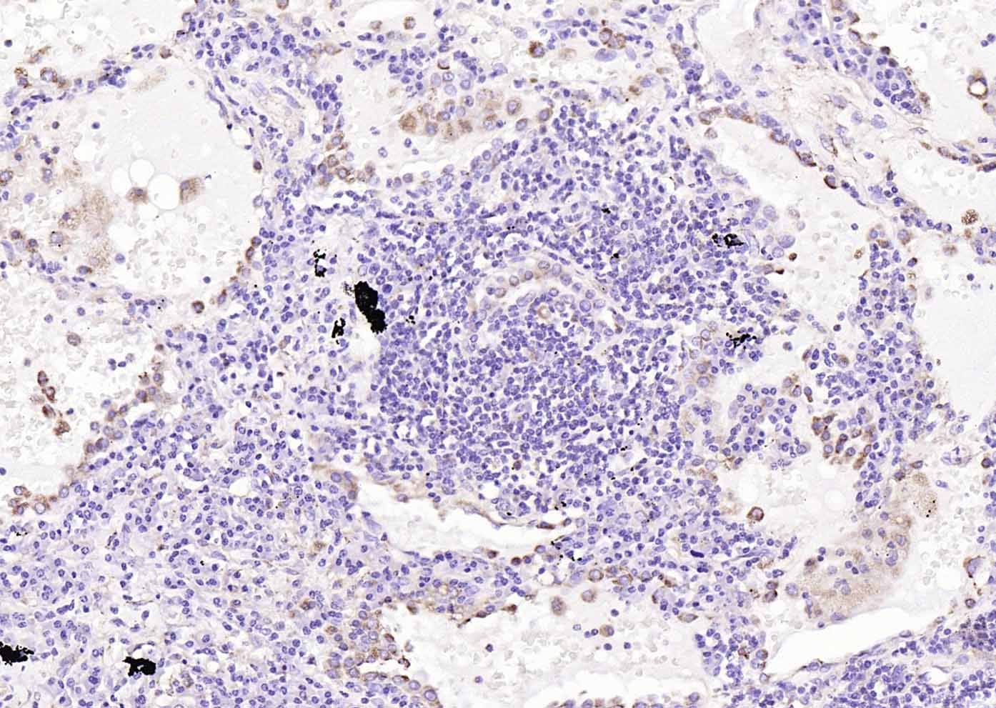 Anti-LAMP1 Polyclonal Antibody