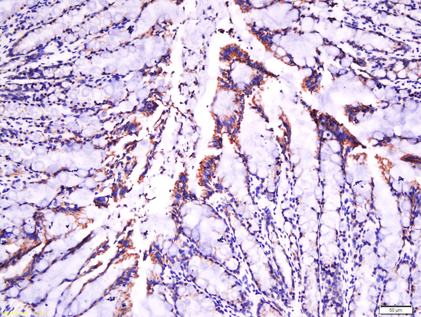 Anti-Laminin subunit beta-1 Polyclonal Antibody