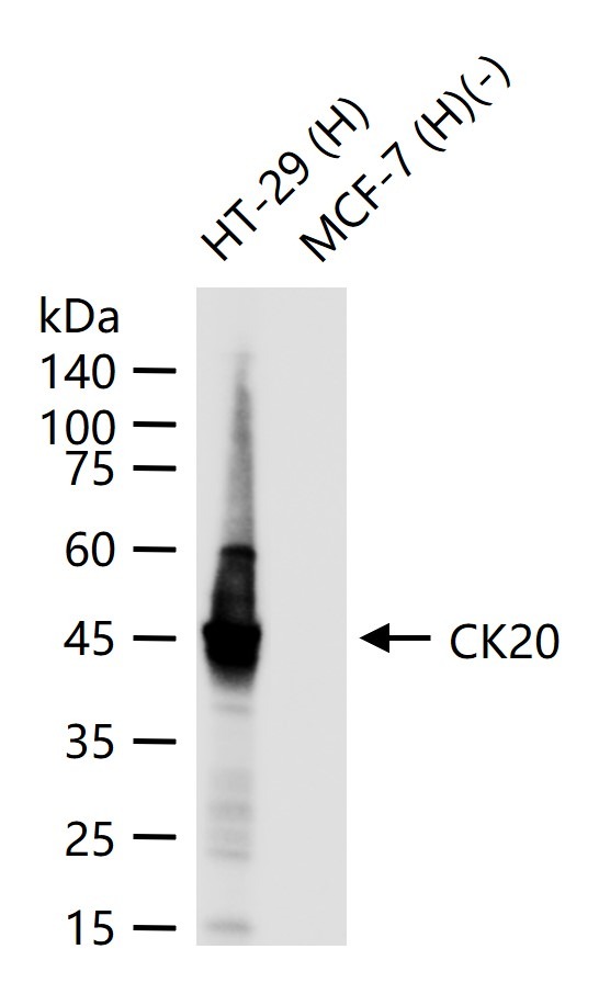 Anti-KRT20 Antibody (9H184)