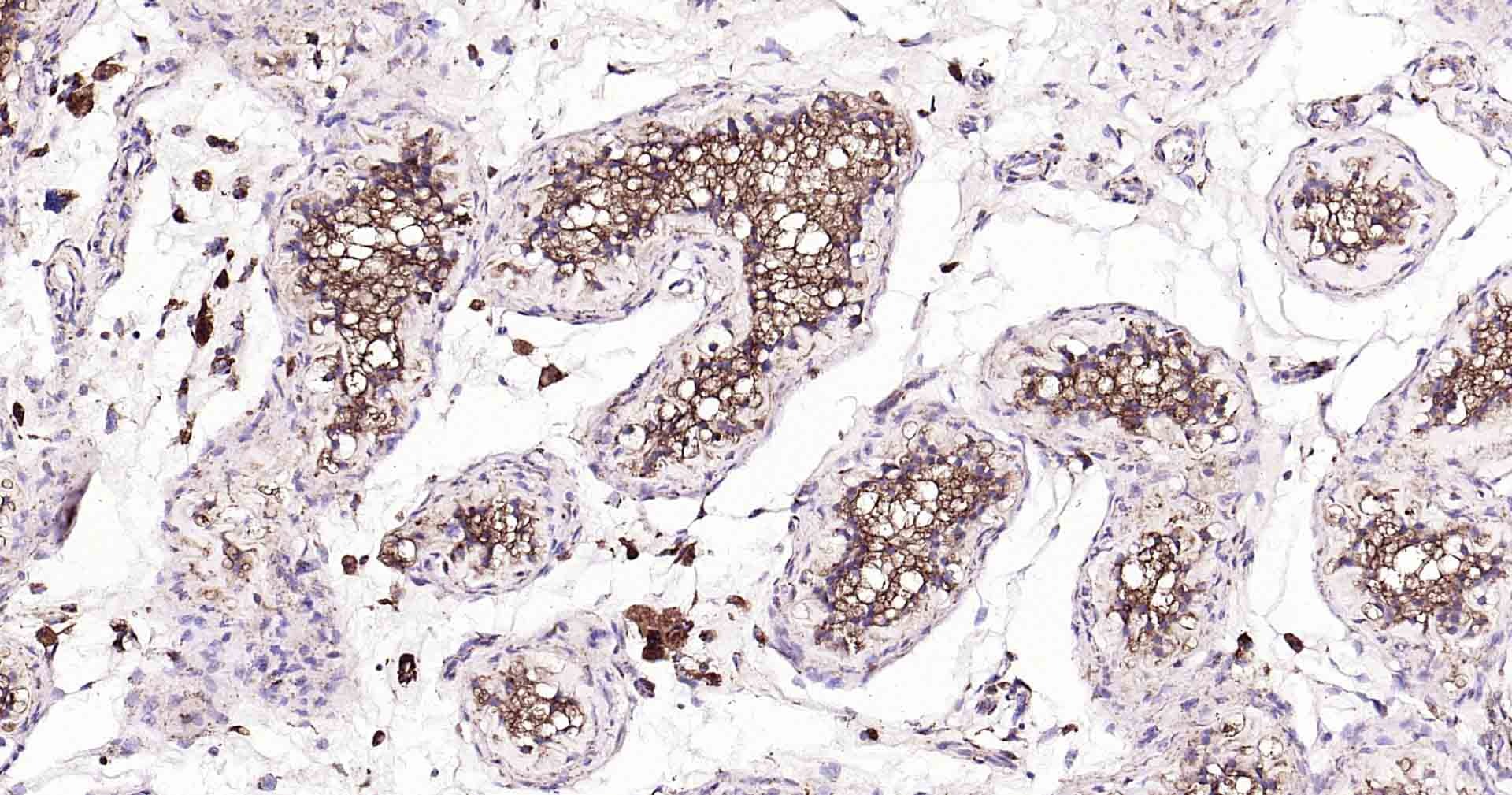 Anti-LAMP1 Polyclonal Antibody